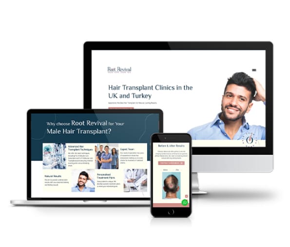 Website Design for UK Hair Transplant Clinic
